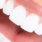 Όσα πρέπει
να ξέρετε για
τη λεύκανση
δοντιών