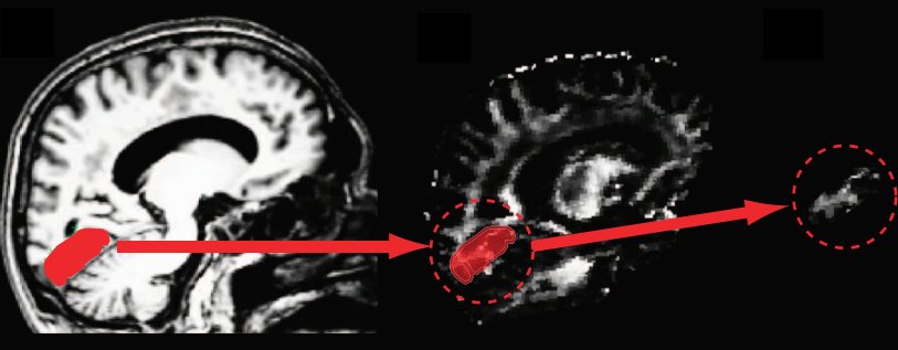 brain_scan_visual_cortex.png