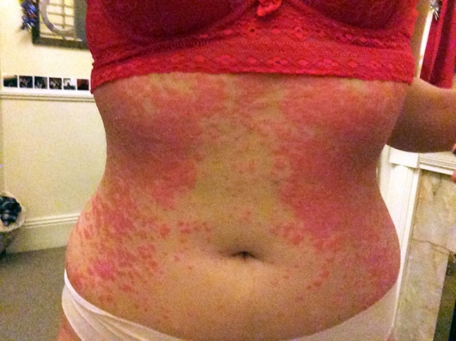 skin2.jpg