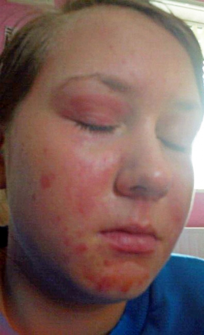 skin3.jpg