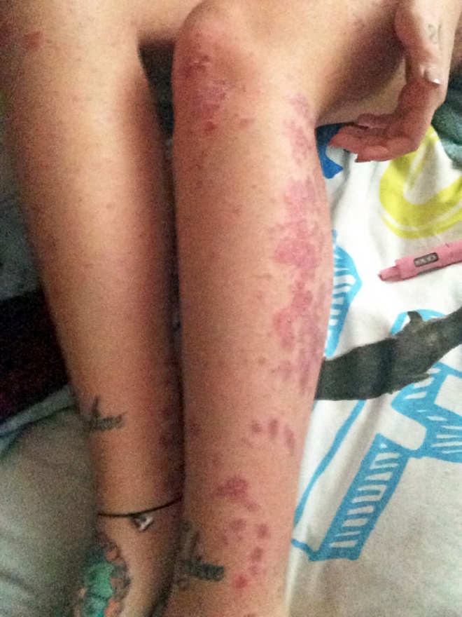 skin4.jpg