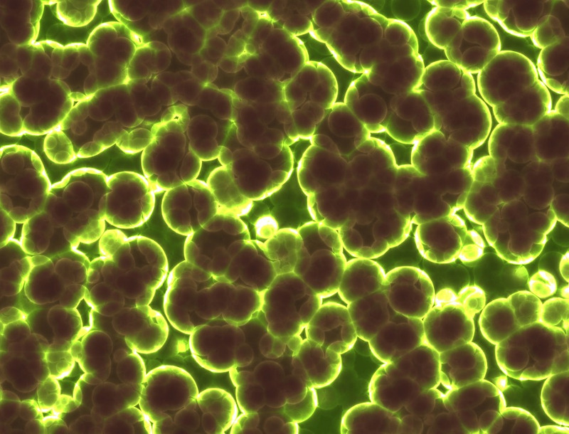 bacteria-1959386_960_720